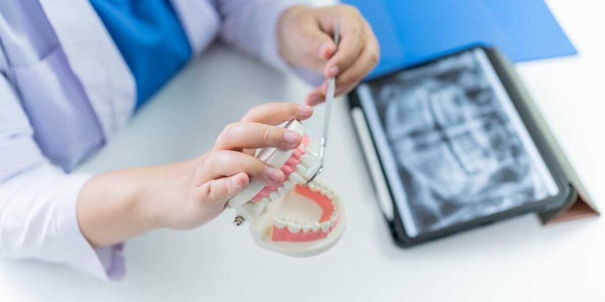 types of damon braces