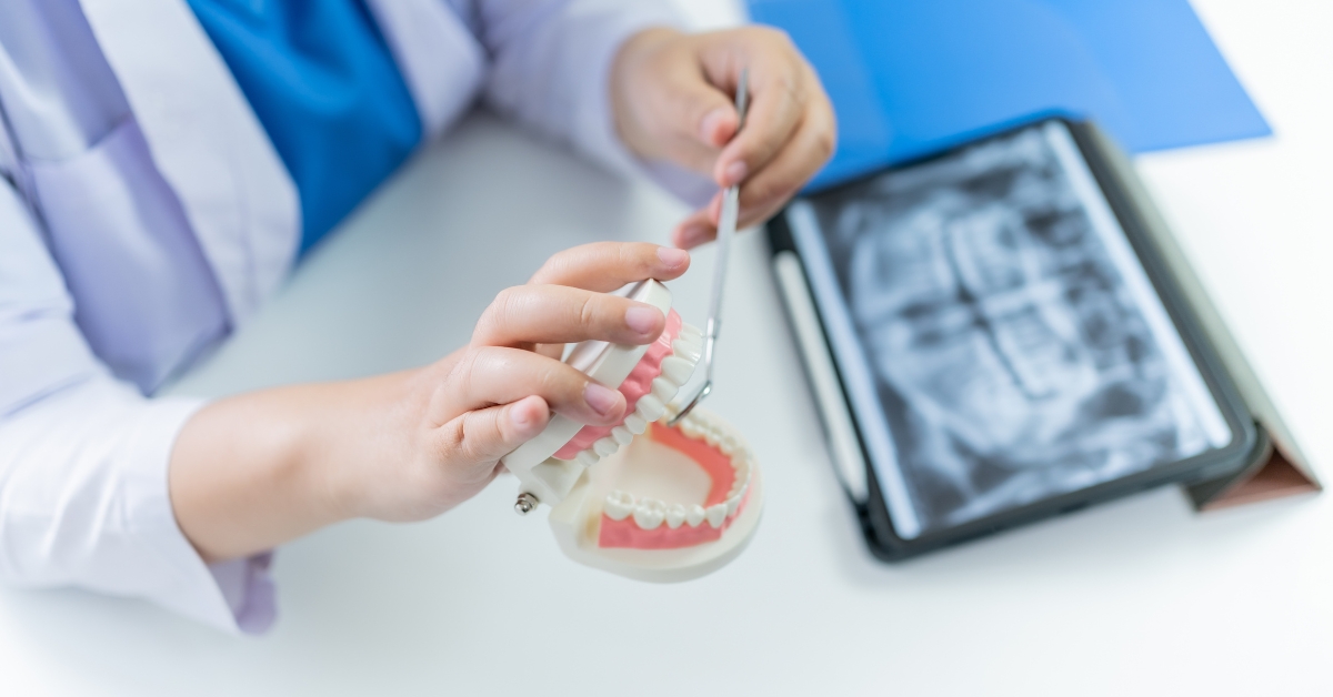 types of damon braces