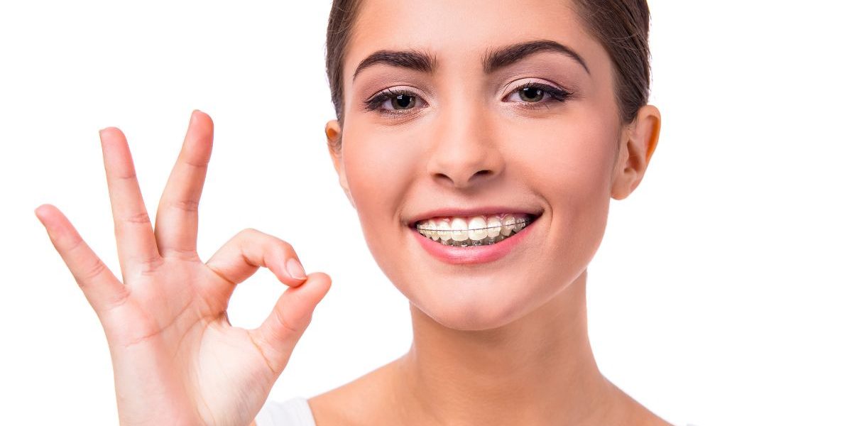 Why Damon System Clear Braces Are Popular in Mississauga damon system clear braces