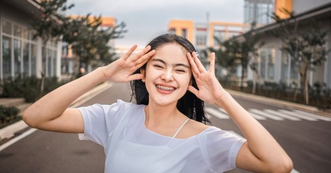 Damon System Braces Cost: Is Premium Pricing Worth the Results? damon system braces cost