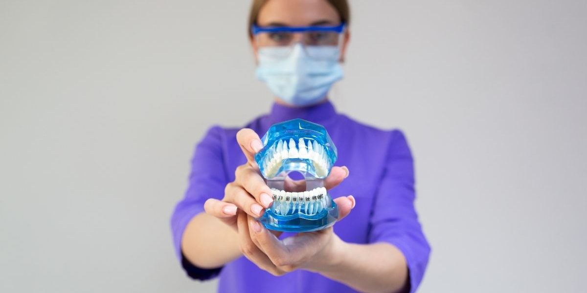 Experience Faster Orthodontic Results with the Damon System in Mississauga damon system in orthodontics