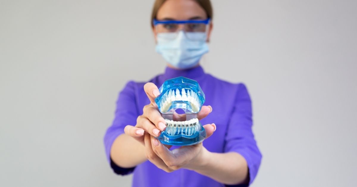 damon system in orthodontics