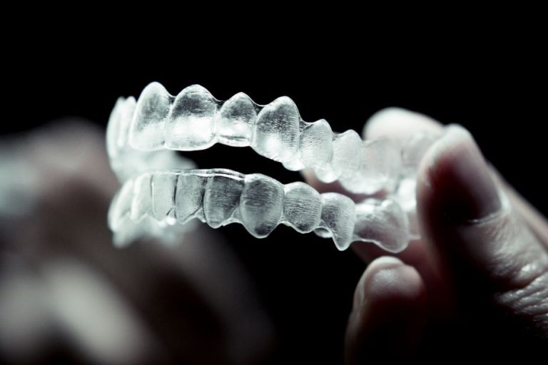 15 (1) invisalign for teens