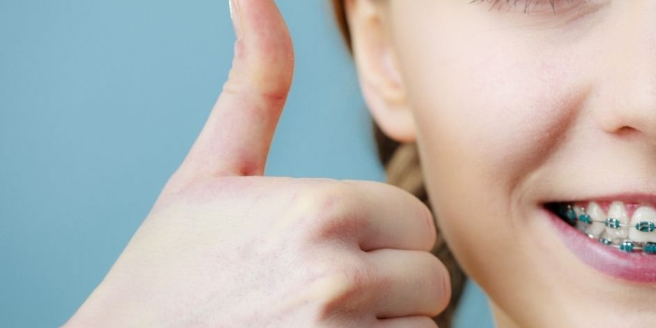 pitts 21 orthodontics