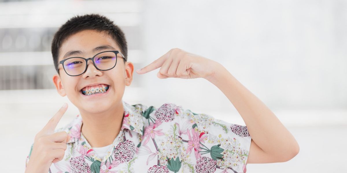 What Are Damon Braces Self-Ligating and Are They Worth It? damon braces self ligating