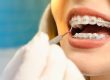 damon ortho brackets near me