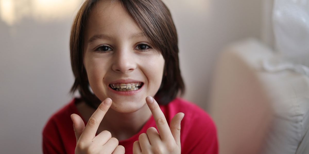 white damon braces near me