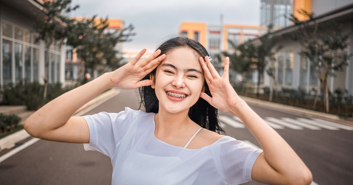 How Damon Fixed Braces Work to Straighten Your Teeth in Toronto damon fixed braces