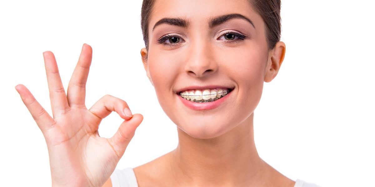 Searching for Damon Braces Near Toronto? Here’s How Orthodontists Can Help damon fixed braces near me