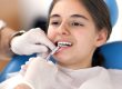 orthodontist damon braces
