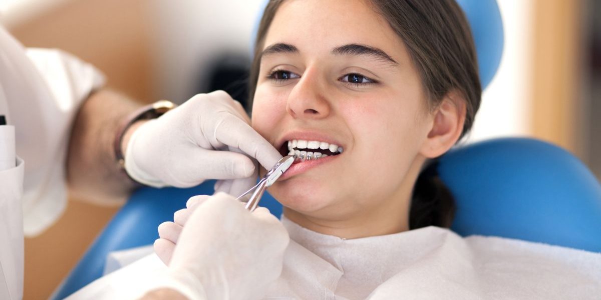 Why More Orthodontists Are Switching to Damon Braces Systems in Toronto orthodontist damon braces