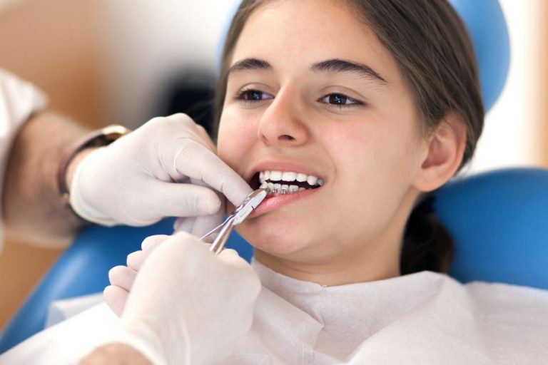 Why More Orthodontists Are Switching to Damon Braces Systems in Toronto orthodontist damon braces