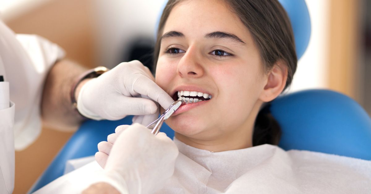 Why More Orthodontists Are Switching to Damon Braces Systems in Toronto orthodontist damon braces