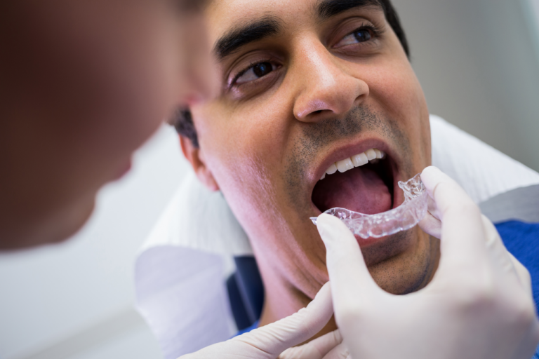 Straighten_teeth