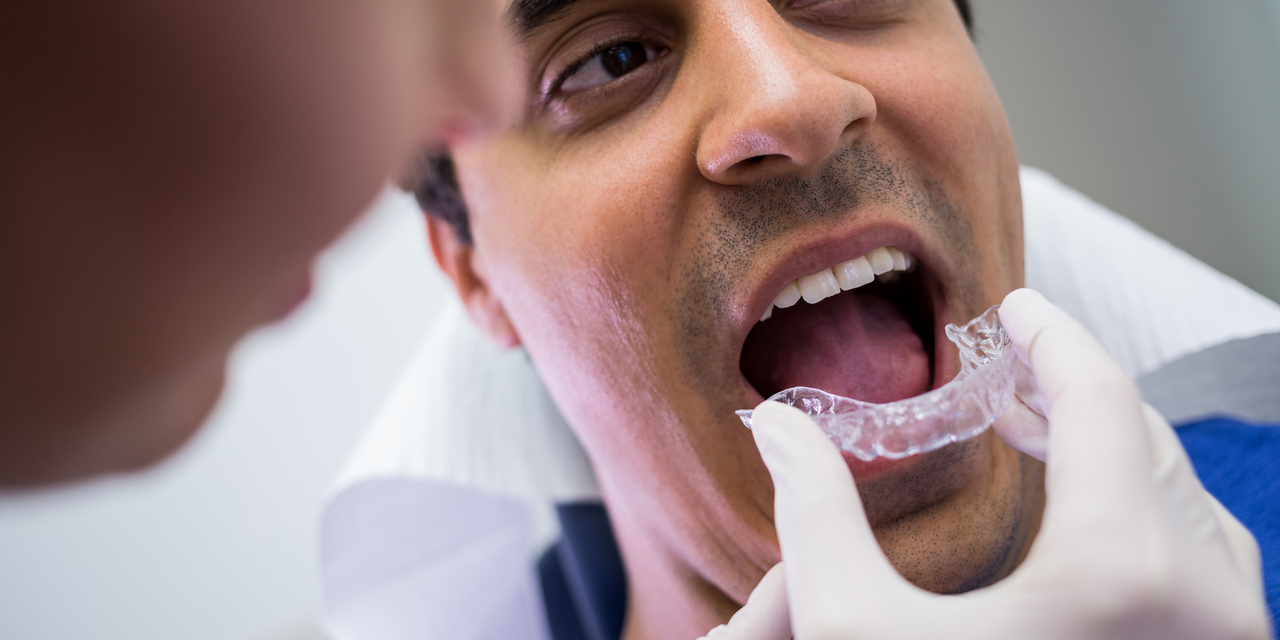 Invisalign